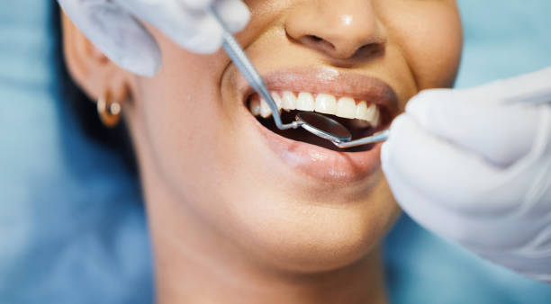 Best Dentist for Tooth Abscess  in Westport, WA